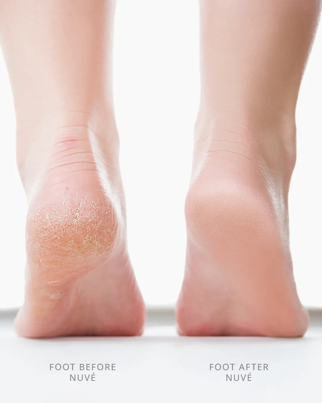 Silk Electric Callus Remover